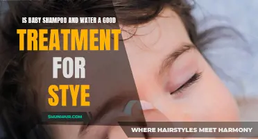 Why Using Baby Shampoo and Water as a Treatment for Stye Might Be Beneficial