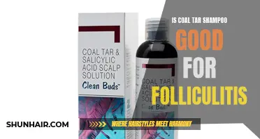 Exploring the Effectiveness of Coal Tar Shampoo for Folliculitis Management