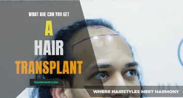 The Ideal Age for Getting a Hair Transplant: A Comprehensive Guide