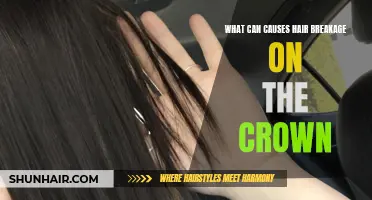 Why Hair Breakage on the Crown Happens and How to Prevent It