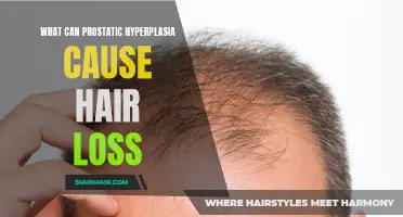 Understanding the Link: Can Prostatic Hyperplasia Contribute to Hair Loss?