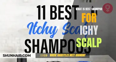 Top Shampoos for Soothing an Itchy Scalp