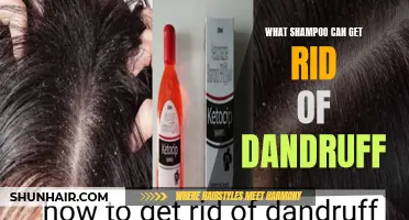 Best Shampoos to Eliminate Dandruff and Restore Scalp Health