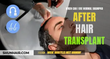 When is it Safe to Use Normal Shampoo After Hair Transplant Surgery?
