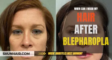 When is it safe to wash my hair after blepharoplasty surgery?