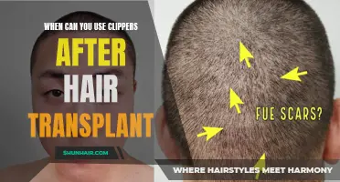 When is it Safe to Use Clippers After a Hair Transplant?