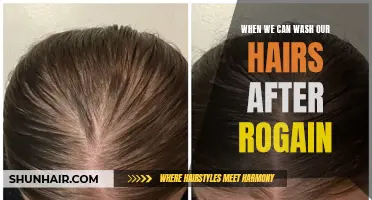 When Can We Wash Our Hair After Using Rogaine?