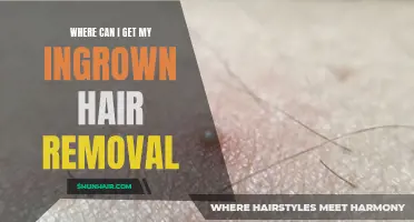 Top 5 Places to Get Professional Ingrown Hair Removal