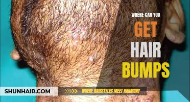 Where Can You Find Solutions for Hair Bumps and Ingrown Hairs?