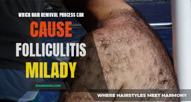 The Culprit Behind Folliculitis: Which Hair Removal Process Can Cause It, Milady?