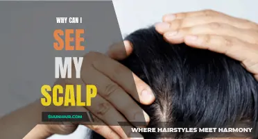 Understanding Why You Can See Your Scalp: Causes and Solutions