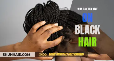 Why Lice Can Thrive on Black Hair: Reasons Behind Their Survival
