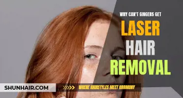 The Struggles of Gingers: The Challenges of Laser Hair Removal
